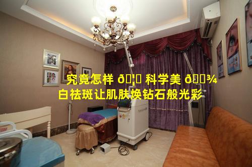 究竟怎样 🦅 科学美 🌾 白祛斑让肌肤焕钻石般光彩